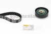 Belt Kit CT988K3